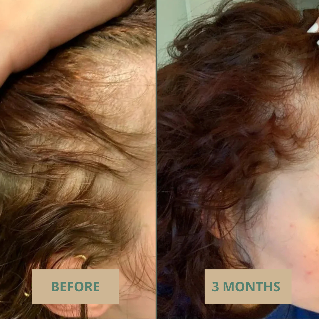 The Korean 10-in-1 Root Growth Oil