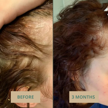 The Korean 10-in-1 Root Growth Oil
